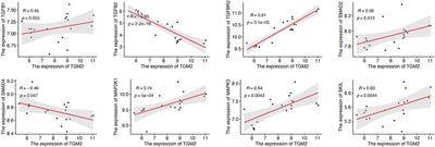 Identification of a Diagnostic Signature and Immune Cell Infiltration Characteristics in Keloids